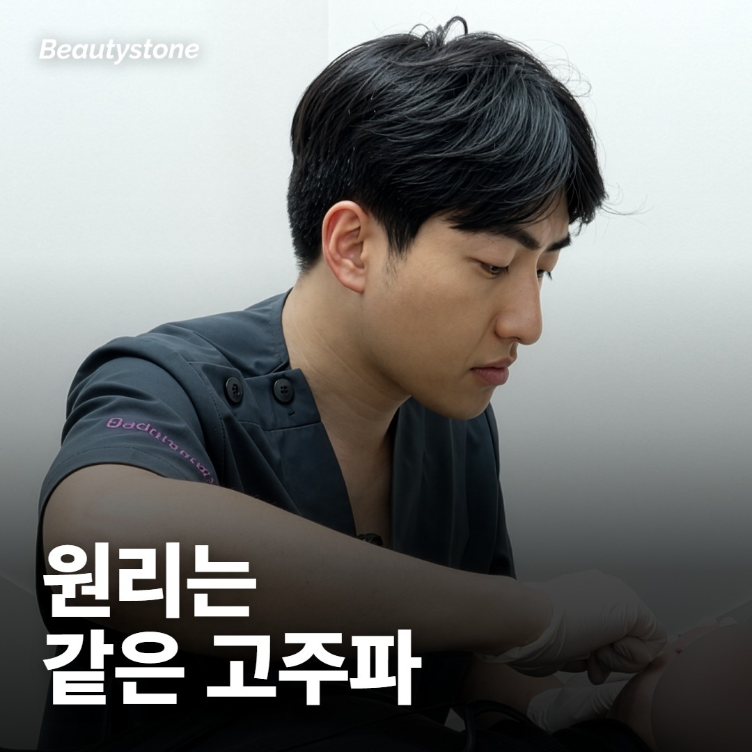 써마지랑 국산 고주파, 원리부터 달라요?