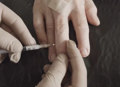 Finger joint (MCP, PIP, DIP) injections