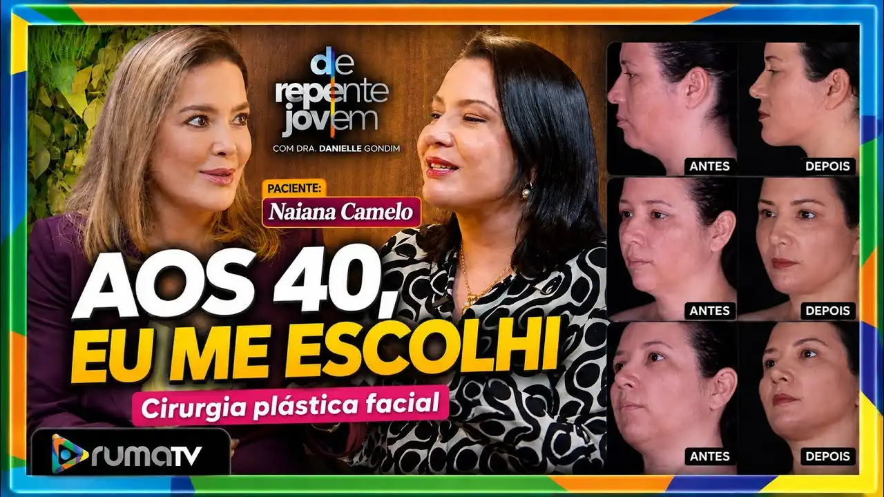 duas mulheres conversando sobre cirurgia plástica, comparação do antes de depois. De repente jovem, aos 40 me escolhi.