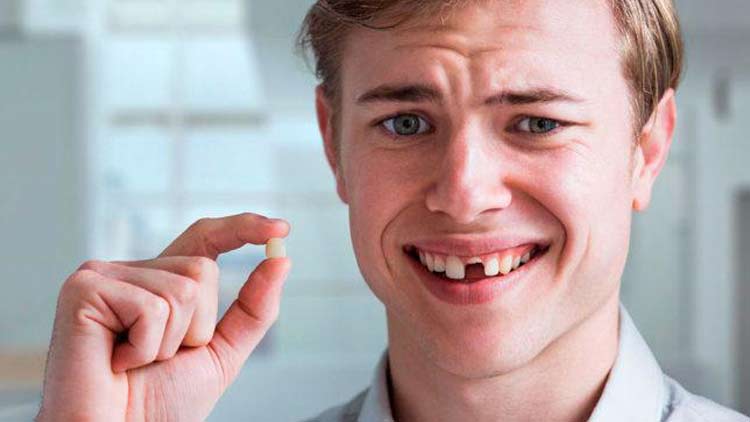 knocked out teeth
