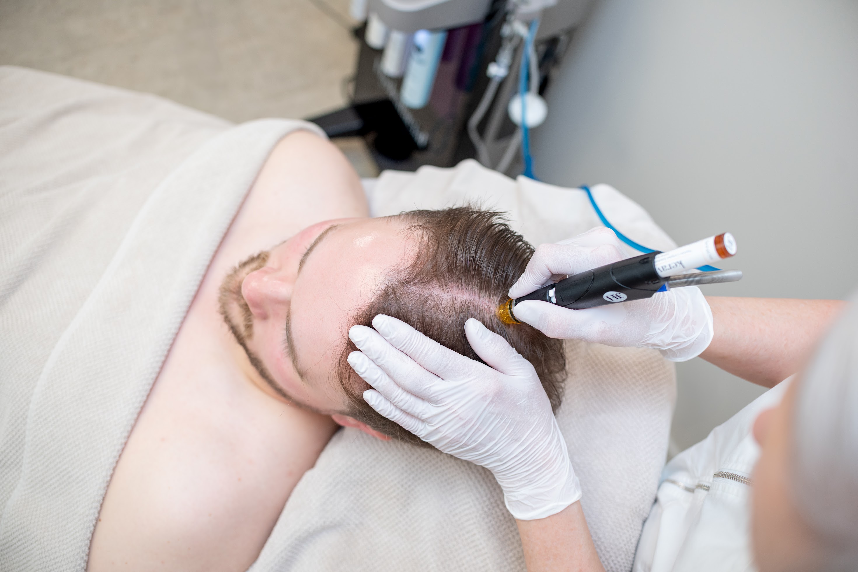 Hydrafacial Keravive, perfekt förberedelse till alla stimulerande hårbottenbehandlingar