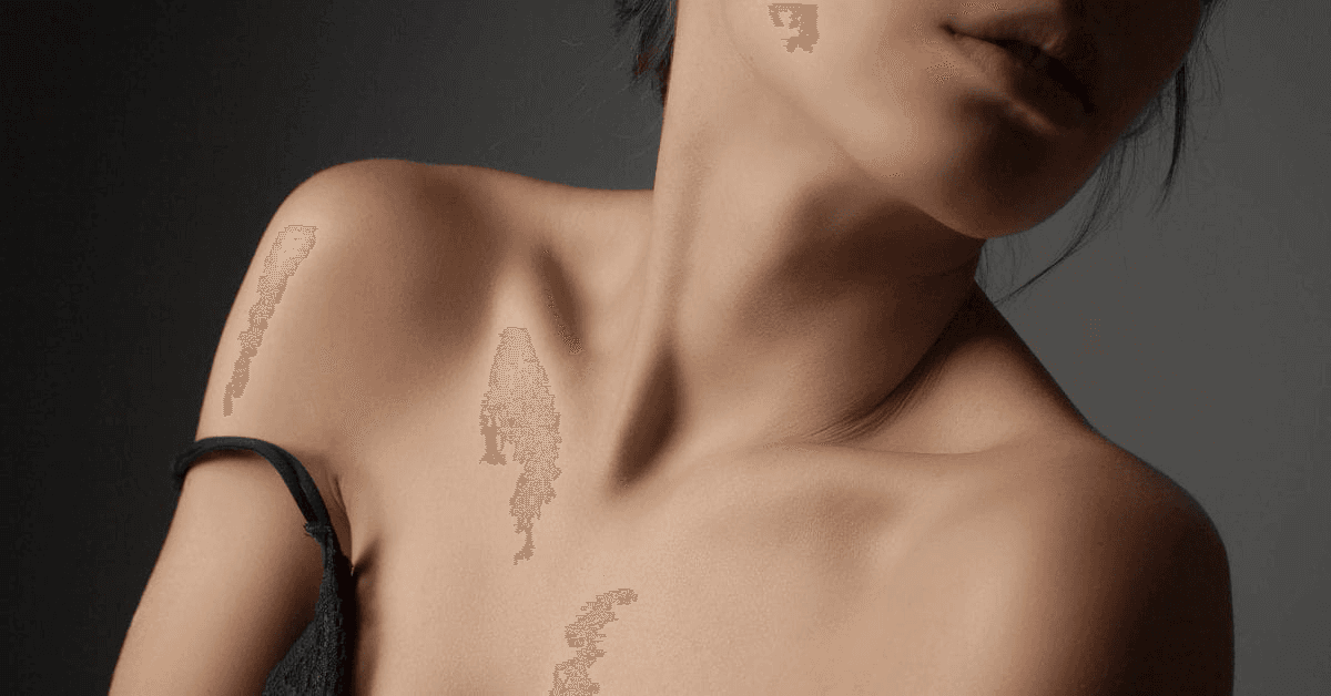 Chest and Décolletage Applications: What Clinics Should Know