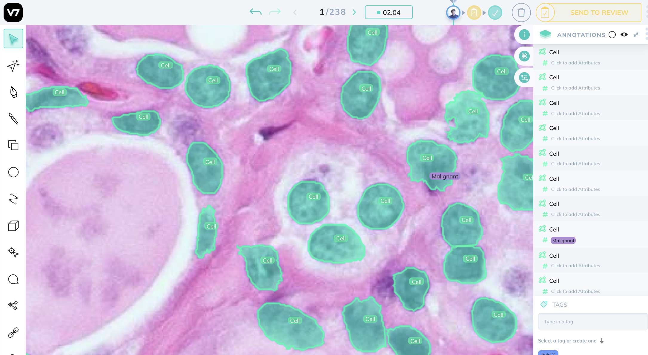 artificial intelligence image annotation in digital pathology