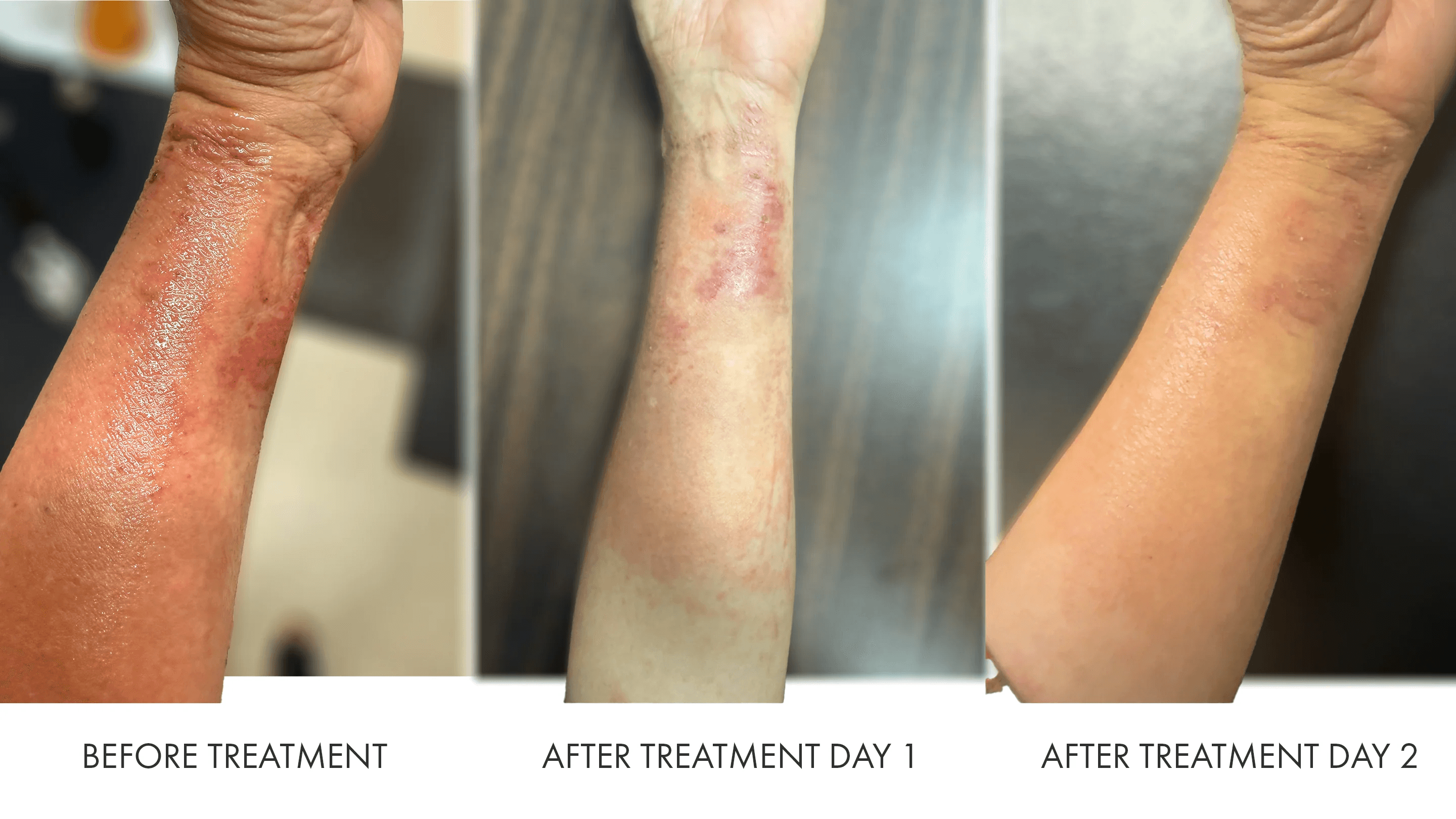 How PDRN Is “Supposed” to Support Skin 