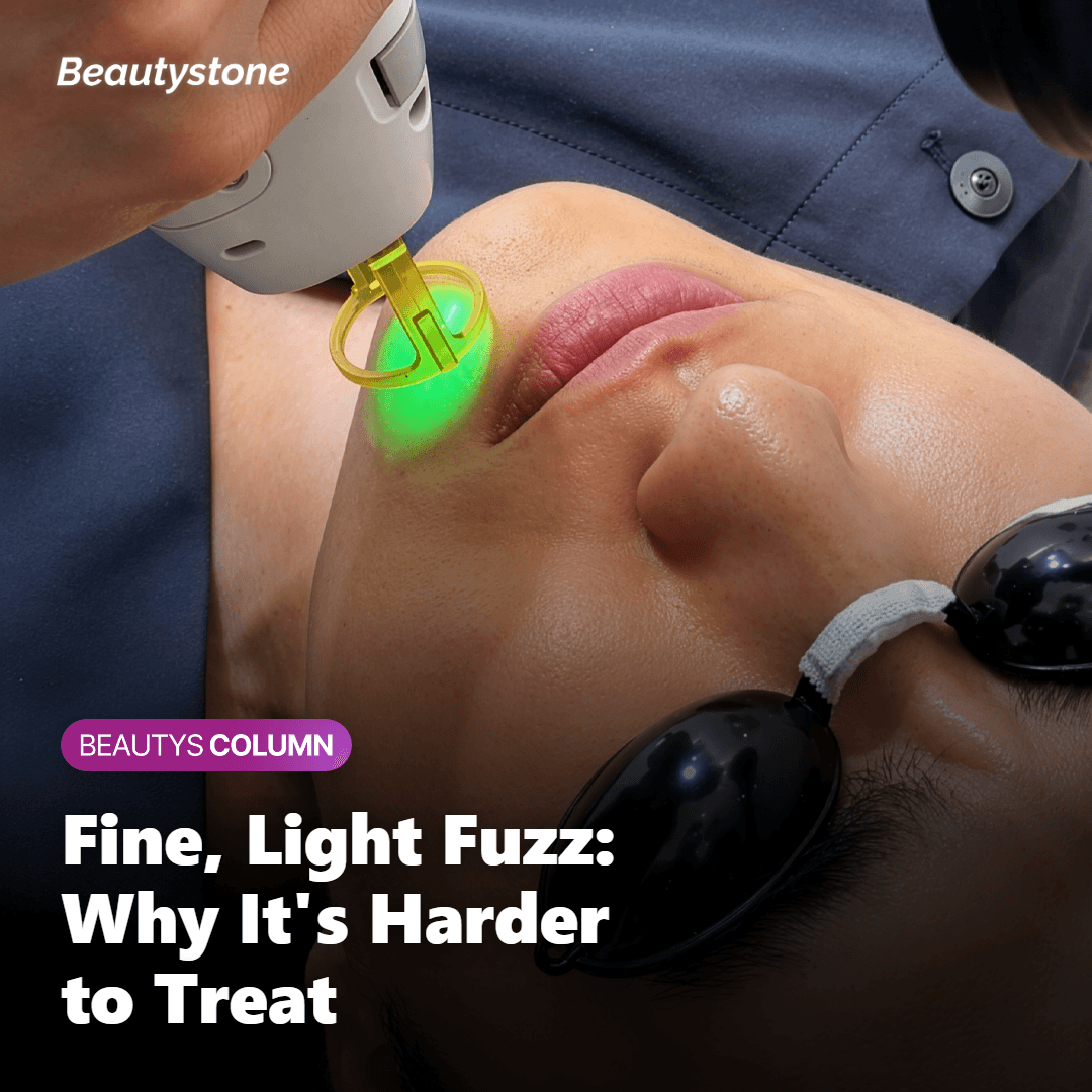 Why Is Fine, Light Facial Hair Harder to Treat?