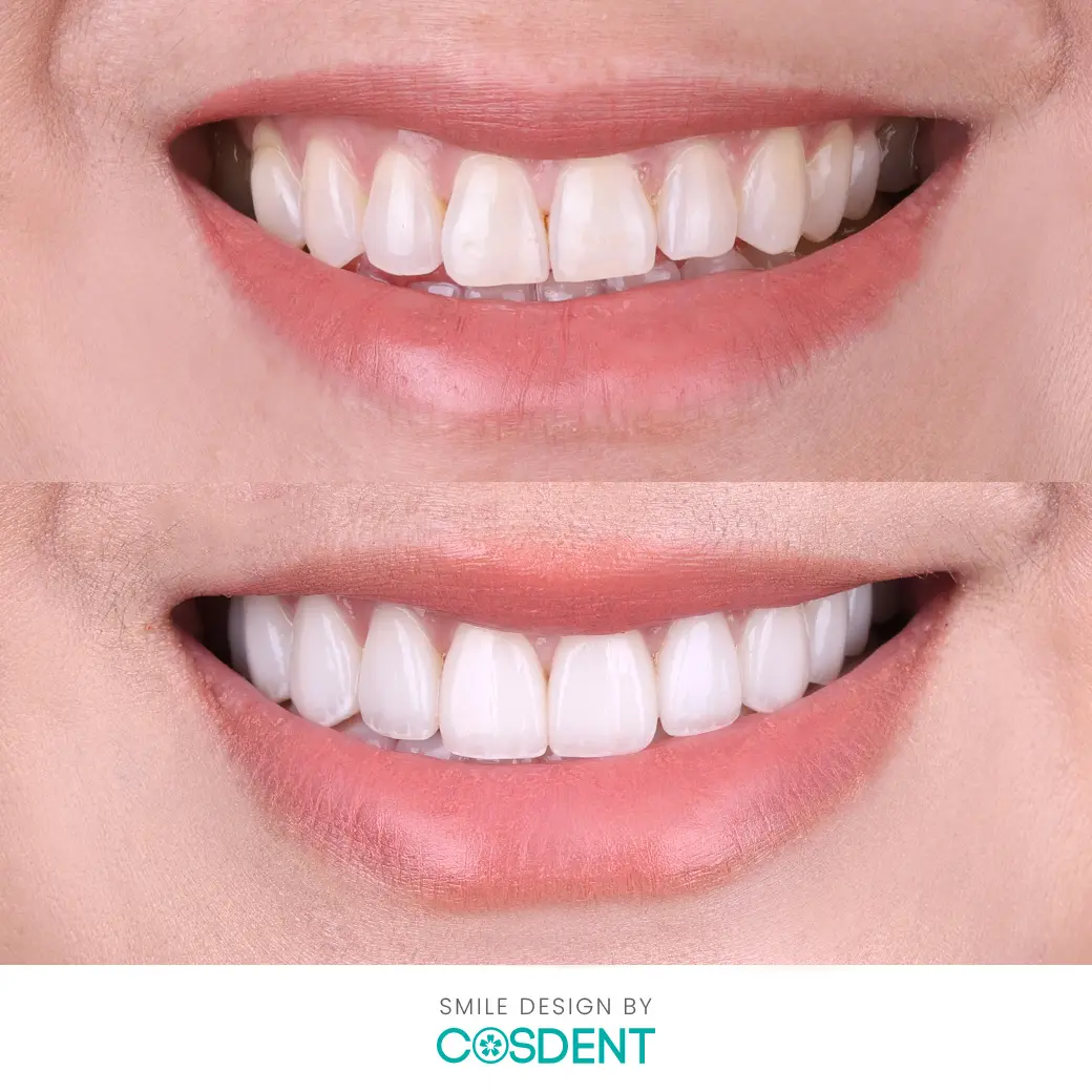 ผู้เชียวชาญแก้ไขทุกความกังวล ที่ cosdent smile design2