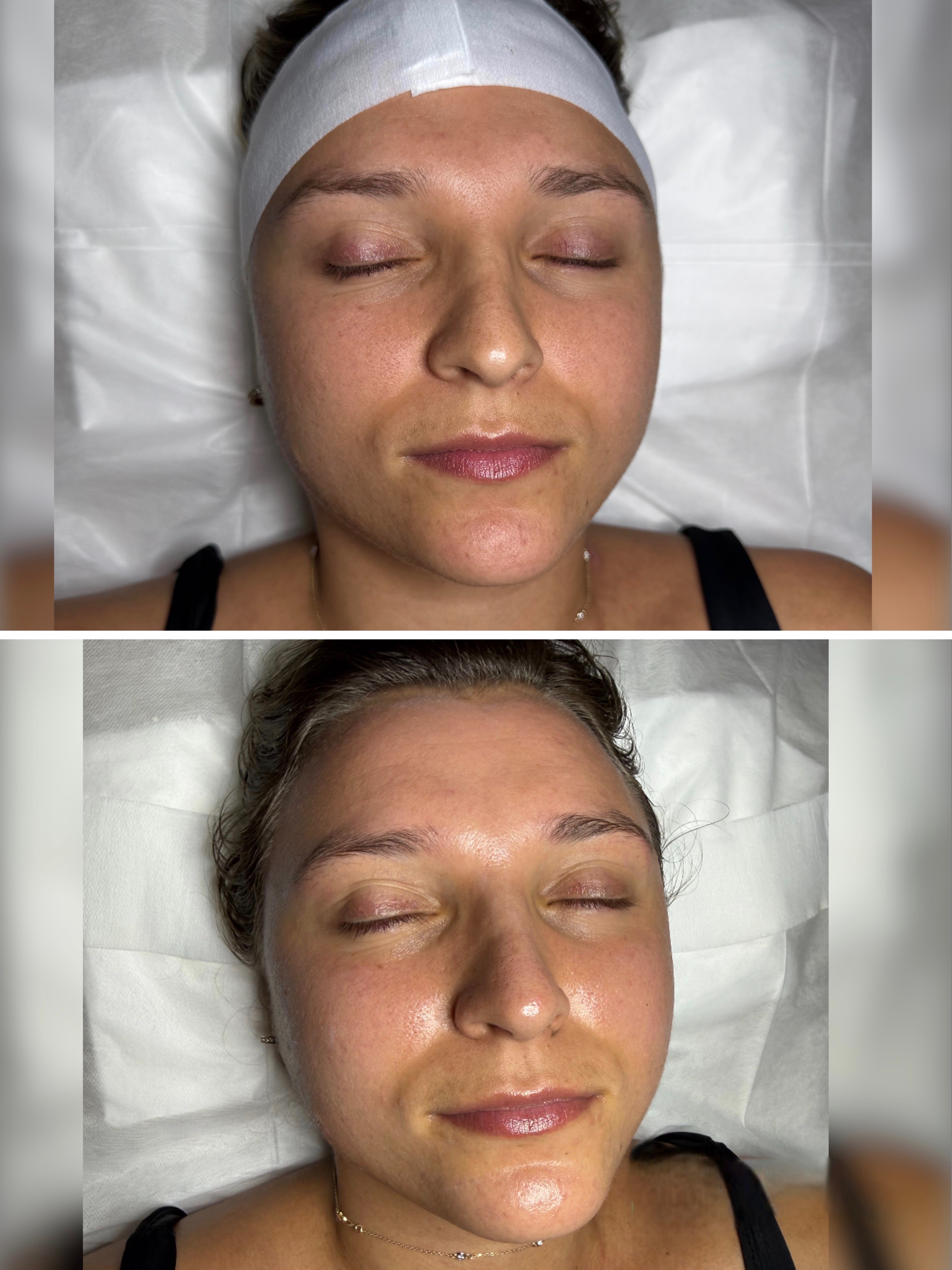 Cleanse and Glow Facial Oyster Bay