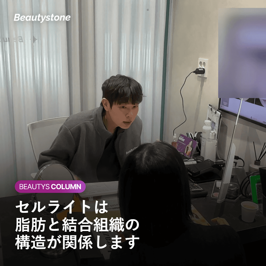 セルライトが脂肪と結合組織の構造で生じることを示す図