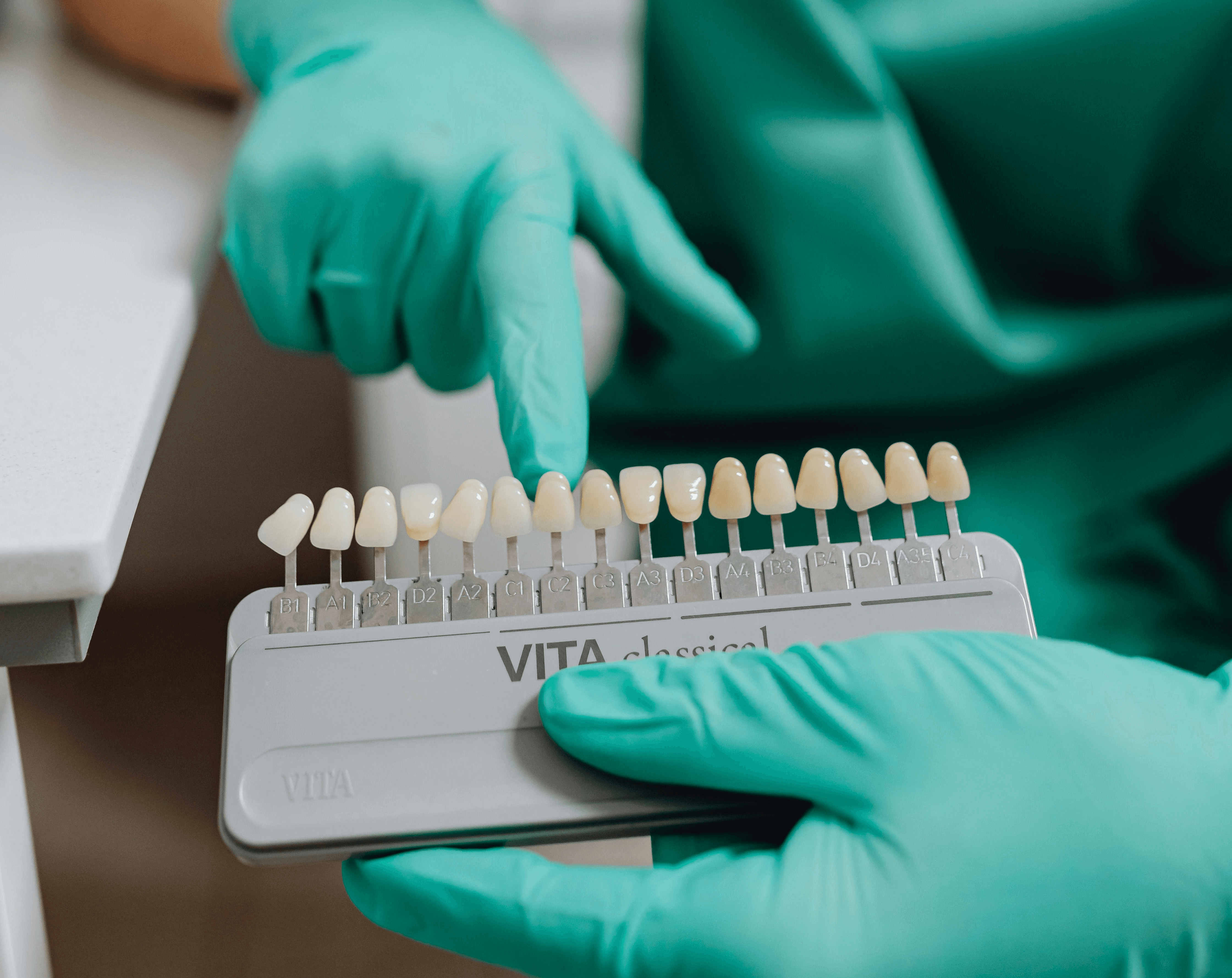 porcelain veneers