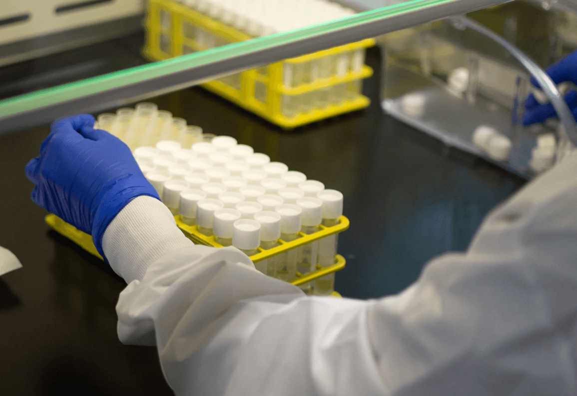 A lab technician prepares semen samples for analysis in the Fellow laboratory.