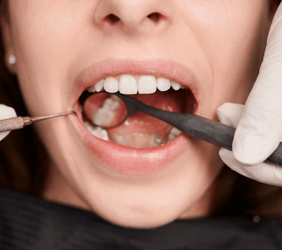 Dental check during wisdom tooth extraction procedure