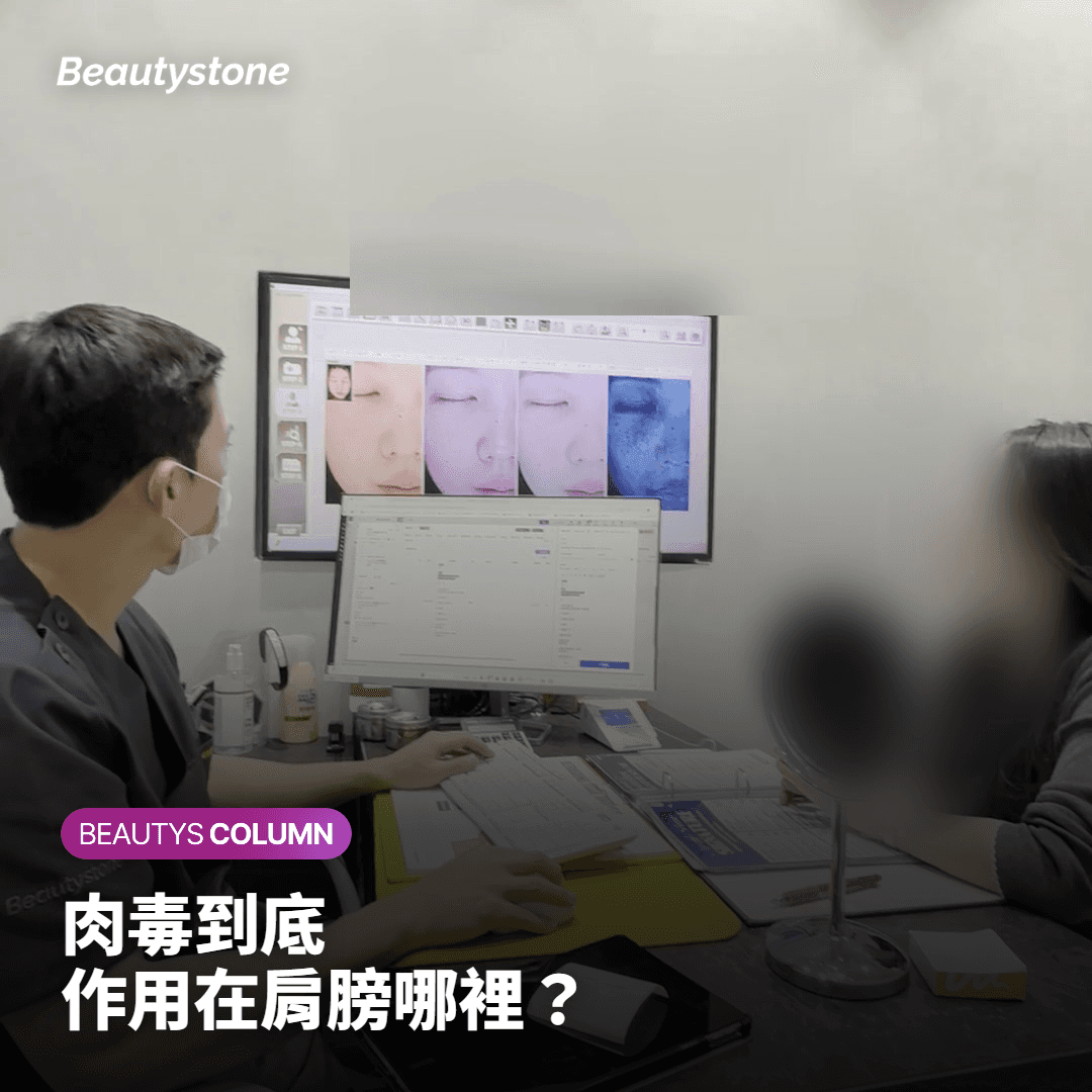 肉毒到底 作用在肩膀哪裡？