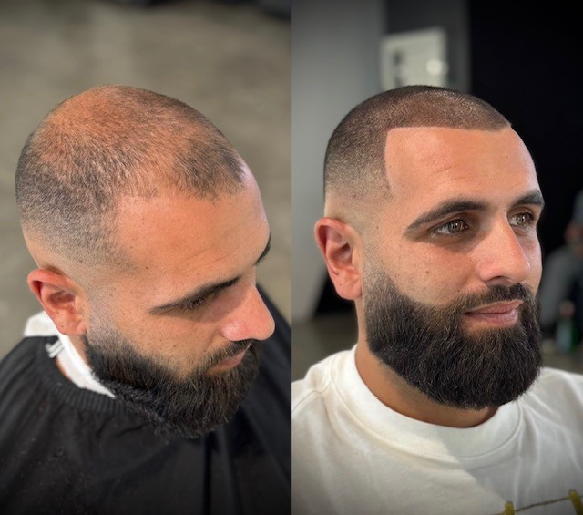 Classic skin fade, detailed beard grooming, hair microfiber enhancements, white male, mens, skilled barber Courtney Palmore at The Rich Barber