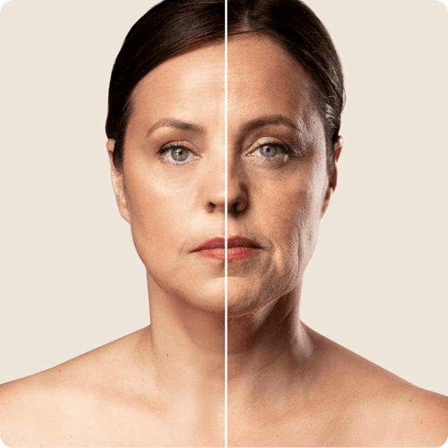 Before-and-after comparison showcasing a person's face before and after receiving anti-aging treatments, such as Botox or dermal fillers. The 'before' image highlights visible signs of aging, including fine lines and wrinkles, while the 'after' image reveals a smoother, more youthful appearance with reduced wrinkles and enhanced facial volume. The individual has a relaxed expression in both images, reflecting the positive results of the anti-aging treatments.