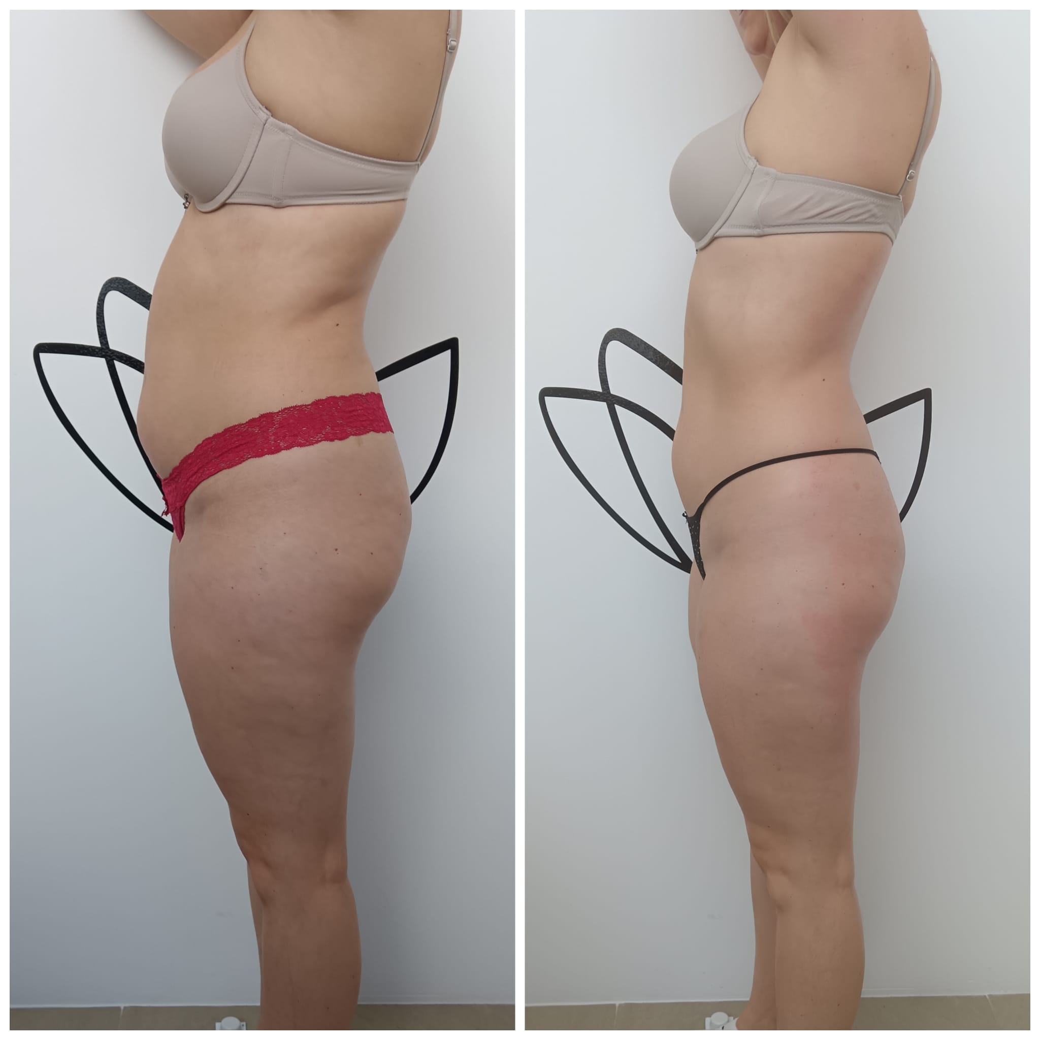 Transformation Photo