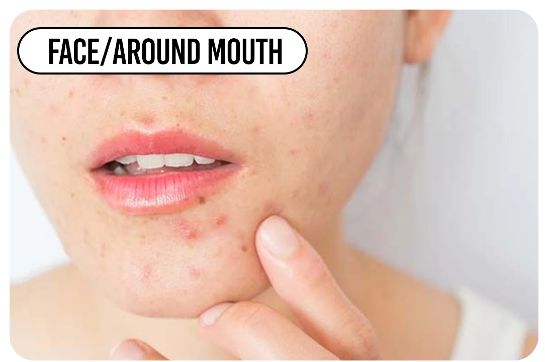 Face / around mouth