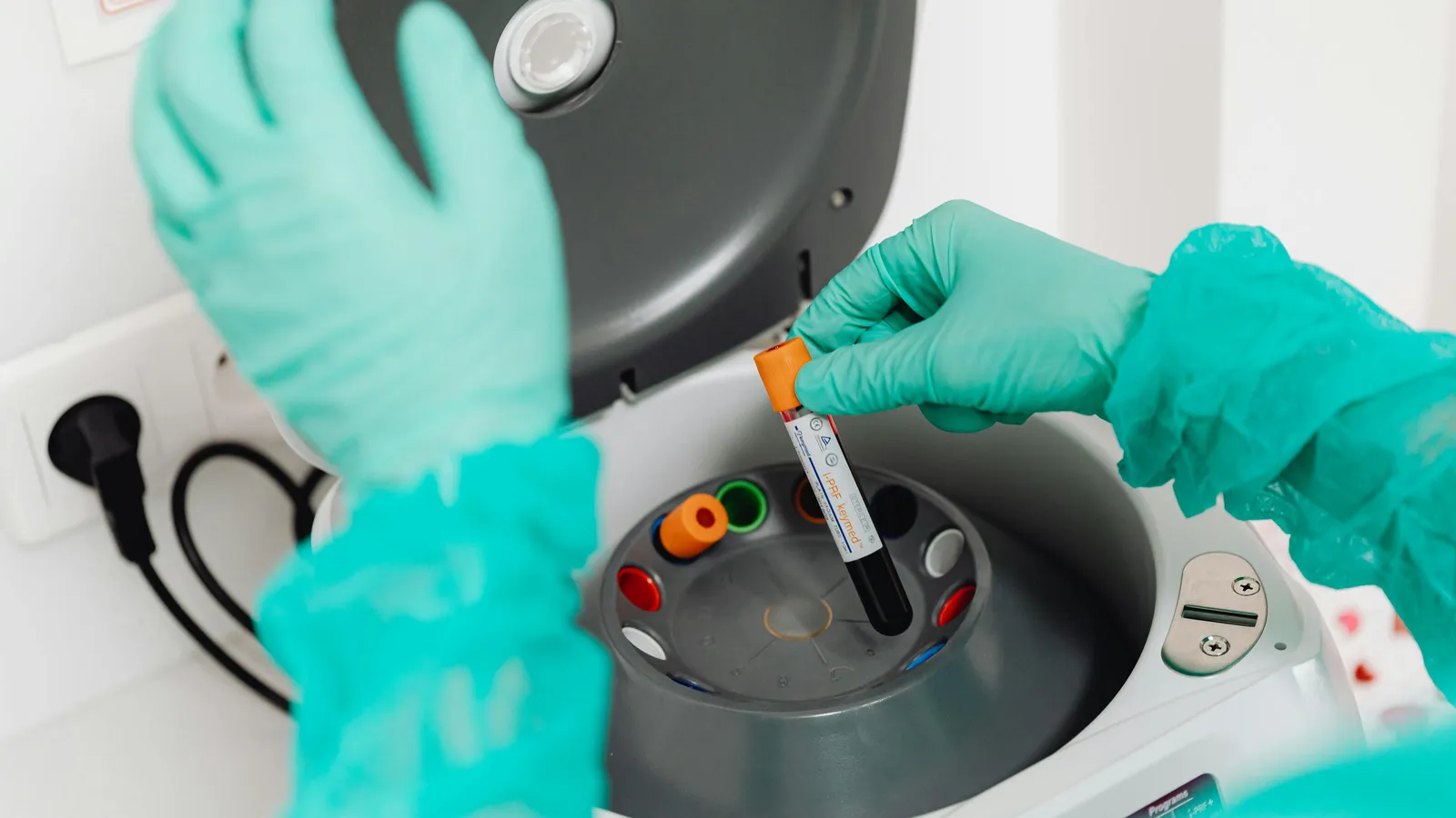 What Causes High Alkaline Phosphatase Levels?