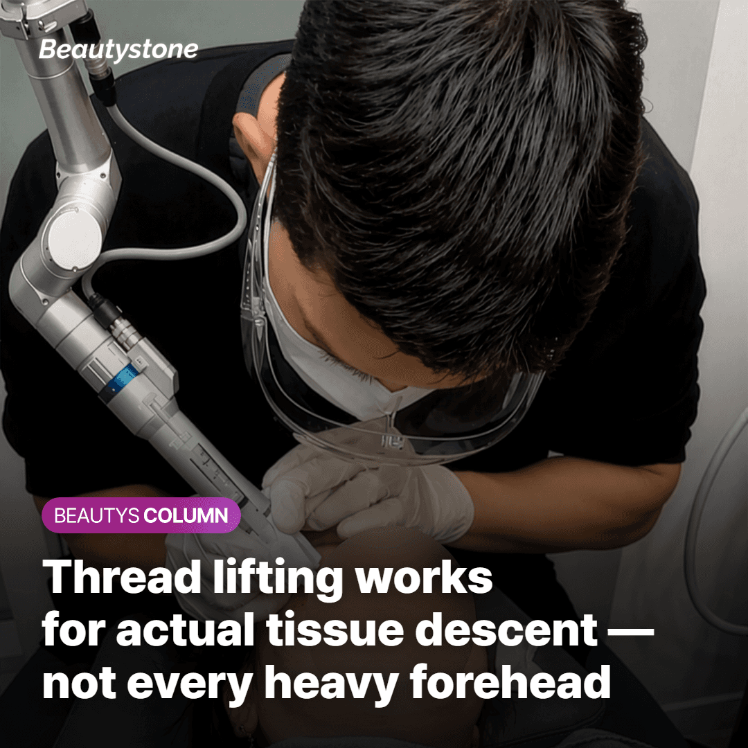 What Can Thread Lifting Actually Achieve on the Forehead?