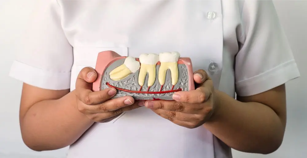 Há situações em que não existe espaço no maxilar para os dentes do siso crescerem