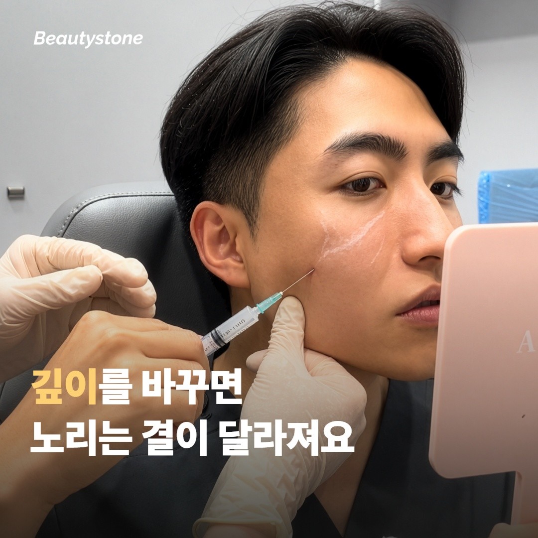 모공·흉터와 탄력·잔주름은 세팅이 달라요
