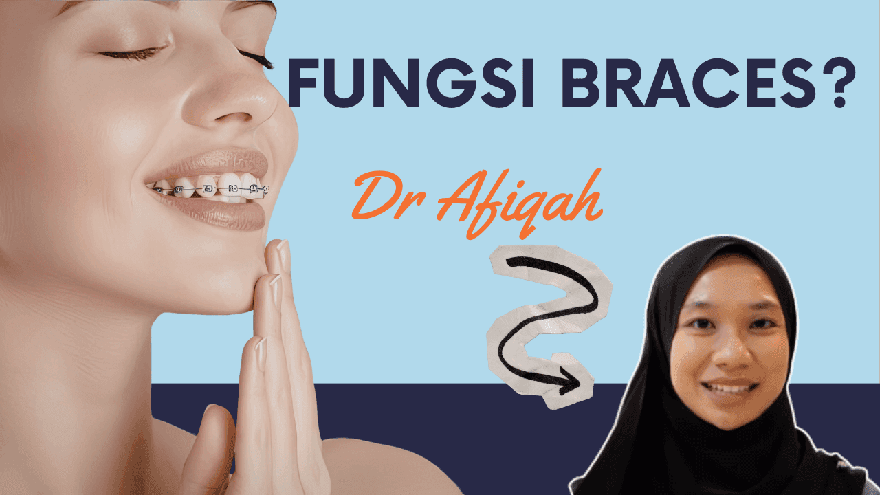 fungsi-fungsi braces