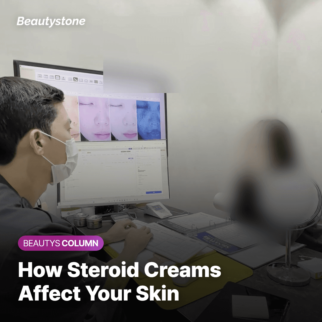 Consultation checklist for patients with topical steroid history before filler or lifting