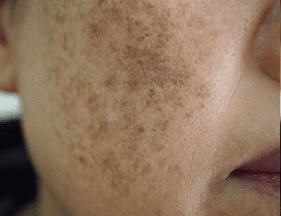 a woman laying on top of a bed holding a hair dryer