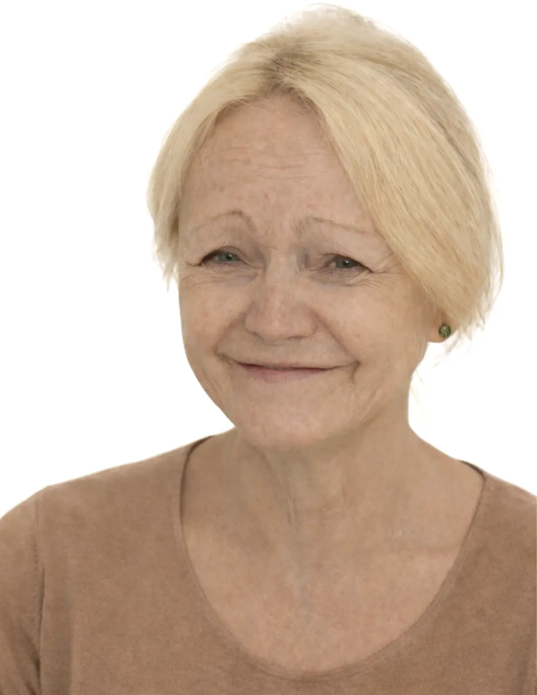 Réhabilitation complète complexe (implants, régénération osseuse, couronnes, prothèses fixes  complètes)