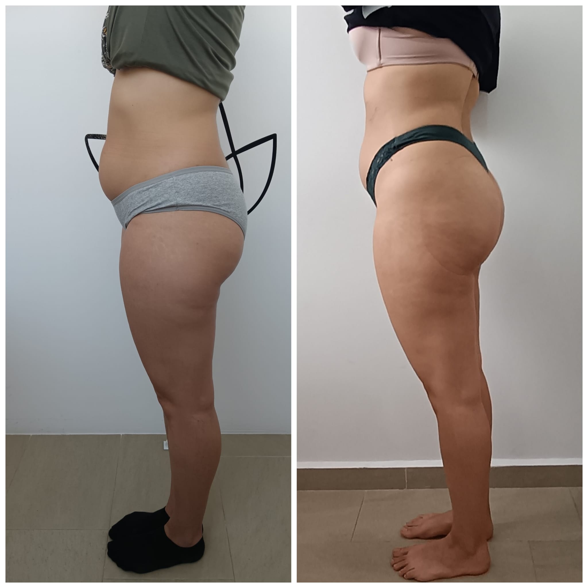 Transformation Photo