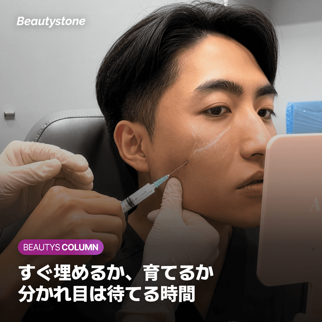 ヒアルロン酸フィラーとスカルプトラの選び分けの基準を比べたカード