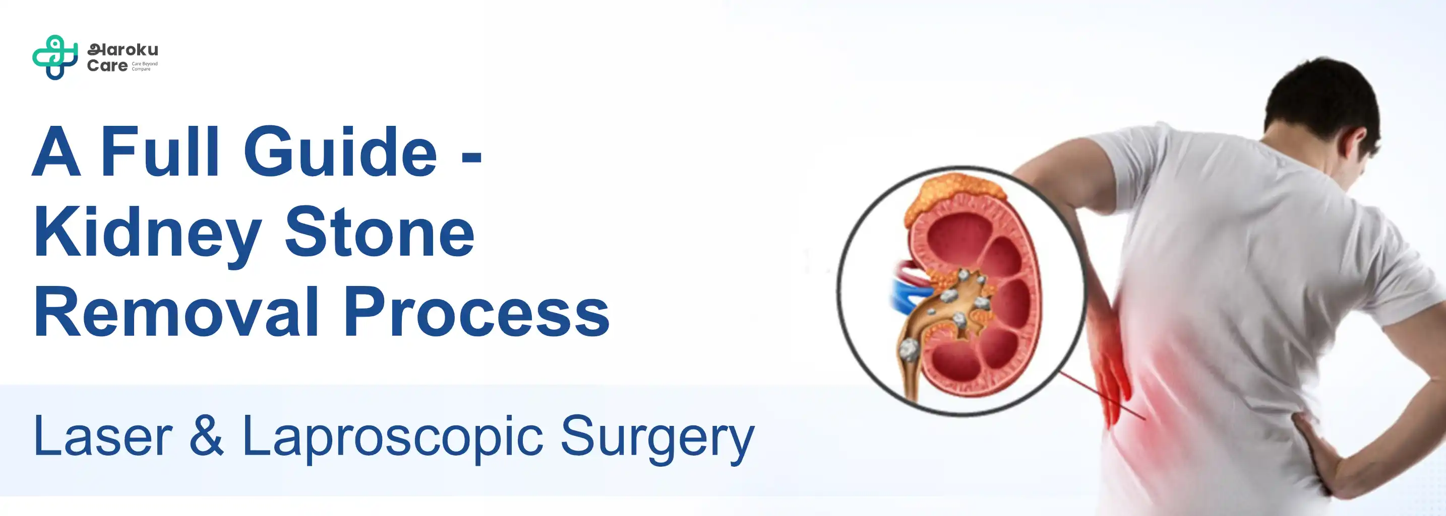 Male chest with gynecomastia before treatment showing enlarged breast tissue