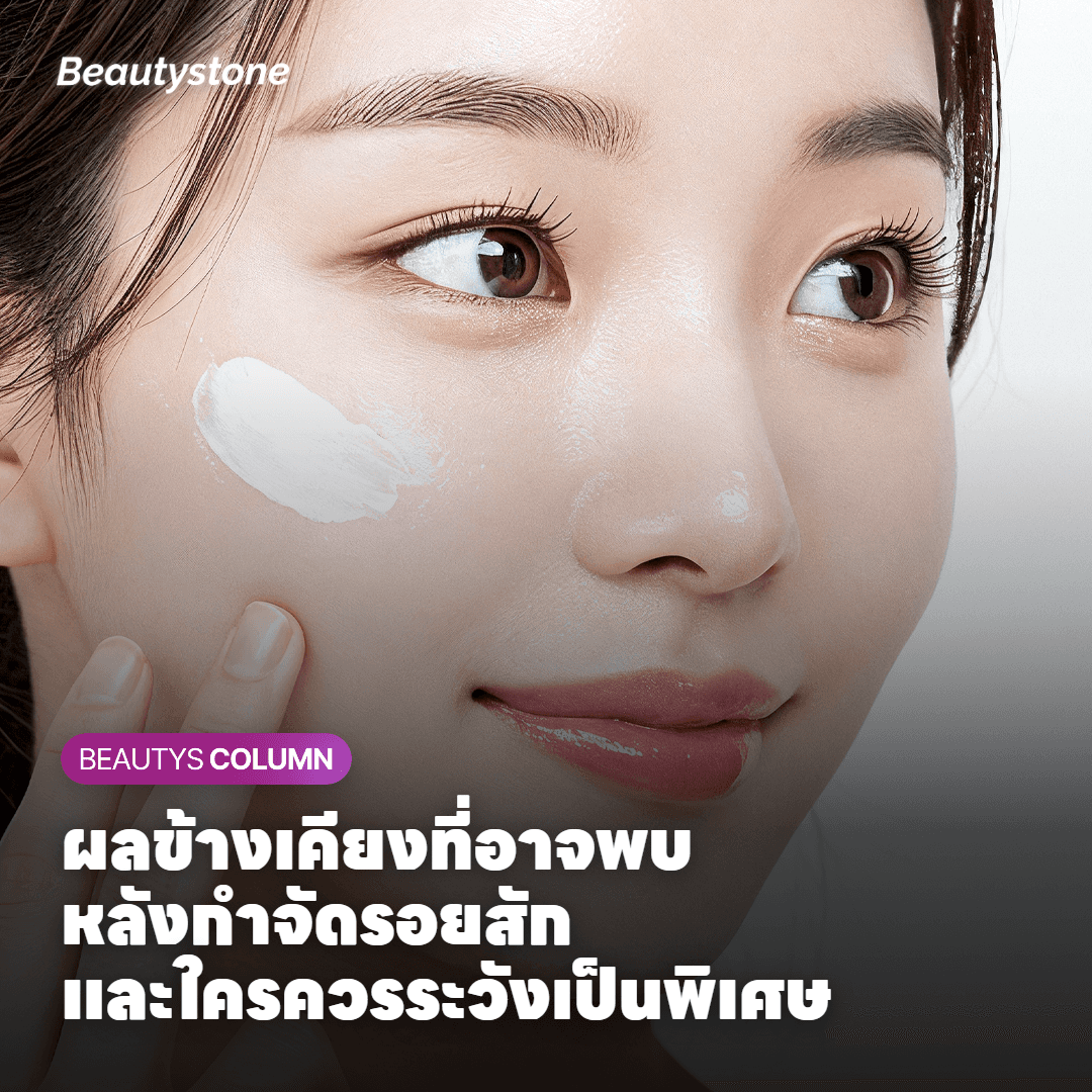 ผลข้างเคียงและข้อควรระวังในการกำจัดรอยสักด้วยเลเซอร์สำหรับผู้ที่เคยทำค้างไว้