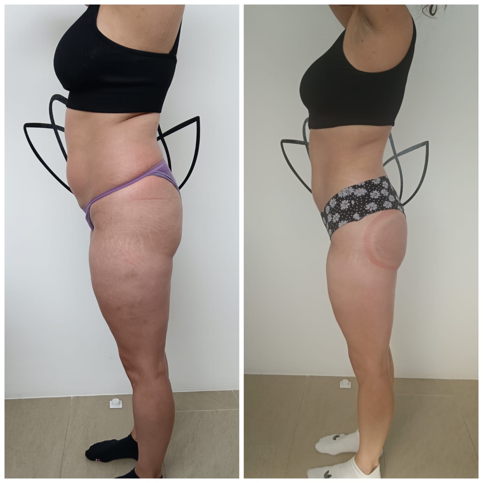 Transformation Photo