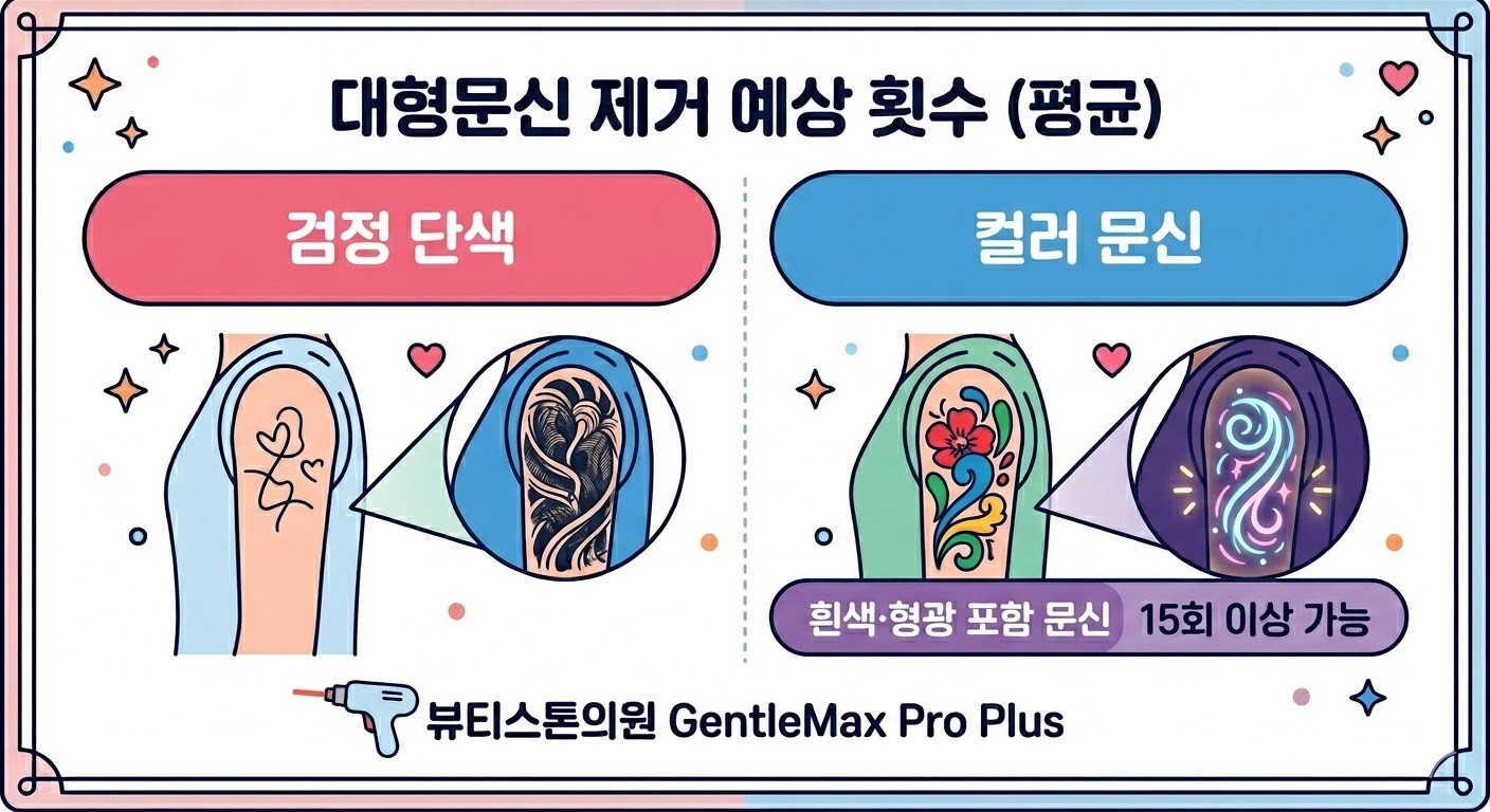 대형문신제거 횟수 결정 요소 - 색상과 잉크 깊이 비교