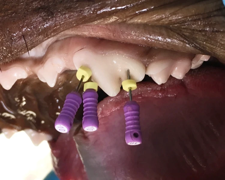 Endodontische Feilen in den Wurzelkanälen eines oberen Reisszahns beim Hund.
