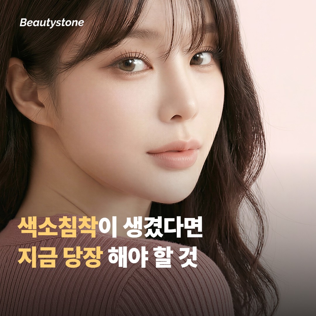색소침착이 이미 생겼다면 대처법