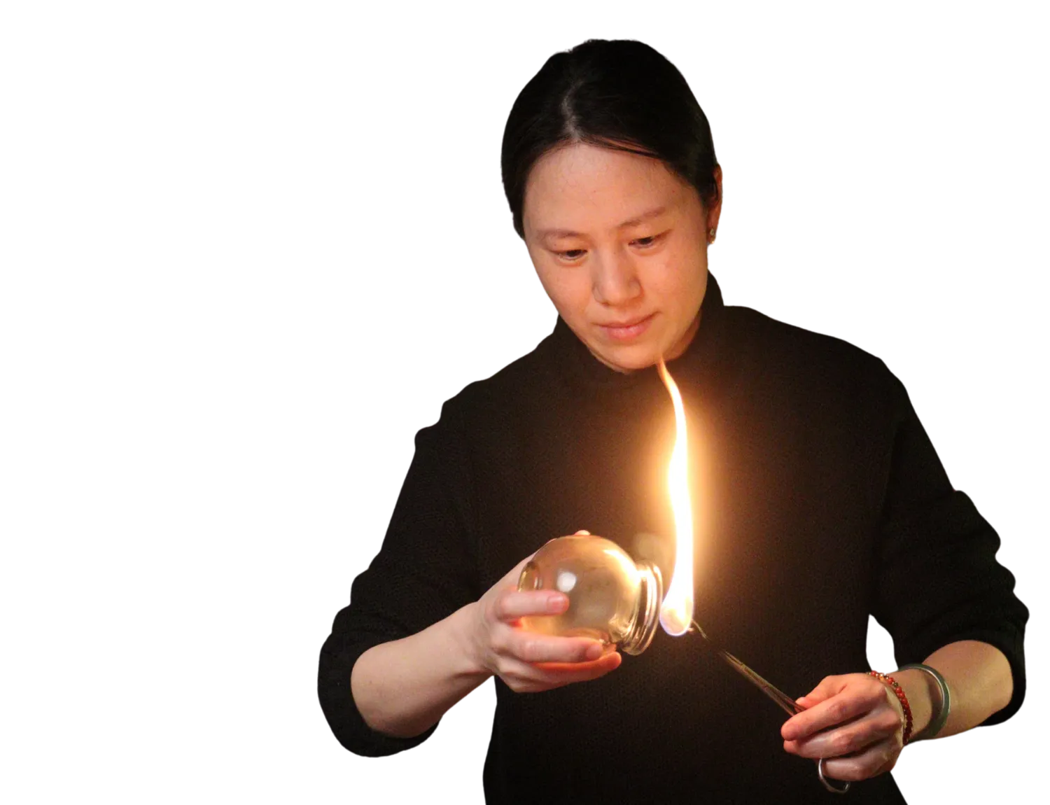 fire cupping performed by a TCM practitioner