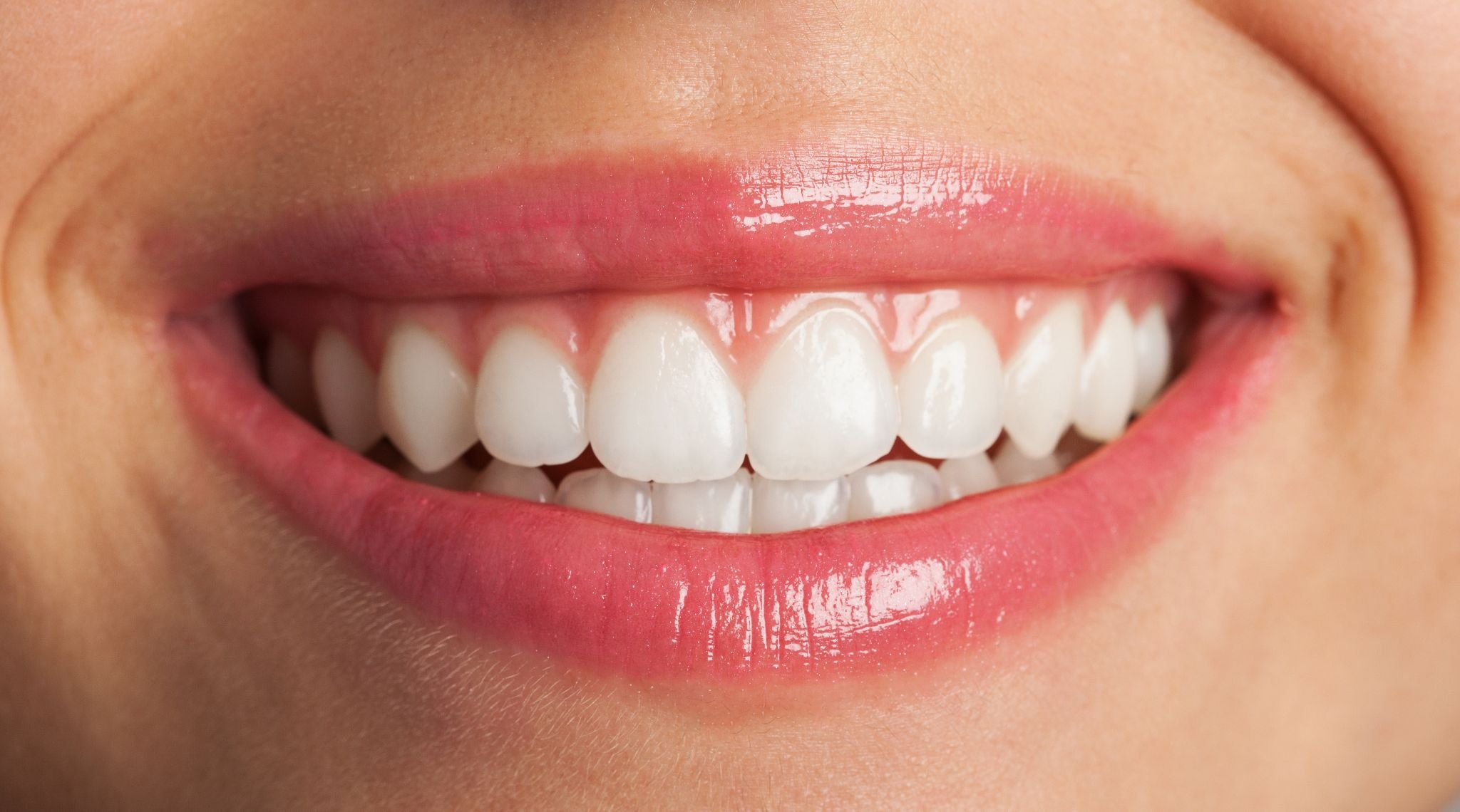 The best treatment for crowded teeth