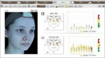 피부_콜라겐벨벳주사_레드색소분석_인포그래픽_르샤인