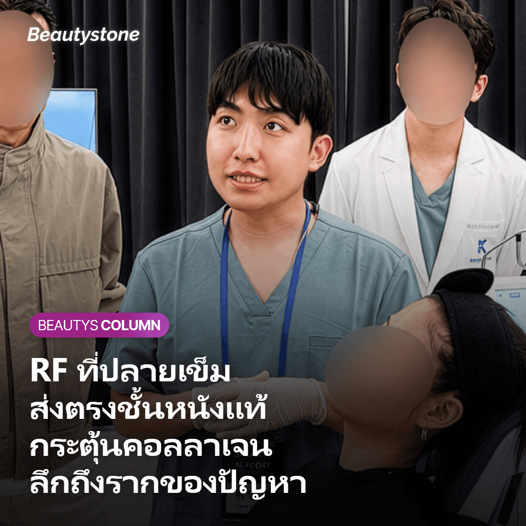 กลไก Secret RF ปล่อยพลังงาน RF ในชั้นหนังแท้เพื่อกระตุ้นคอลลาเจน