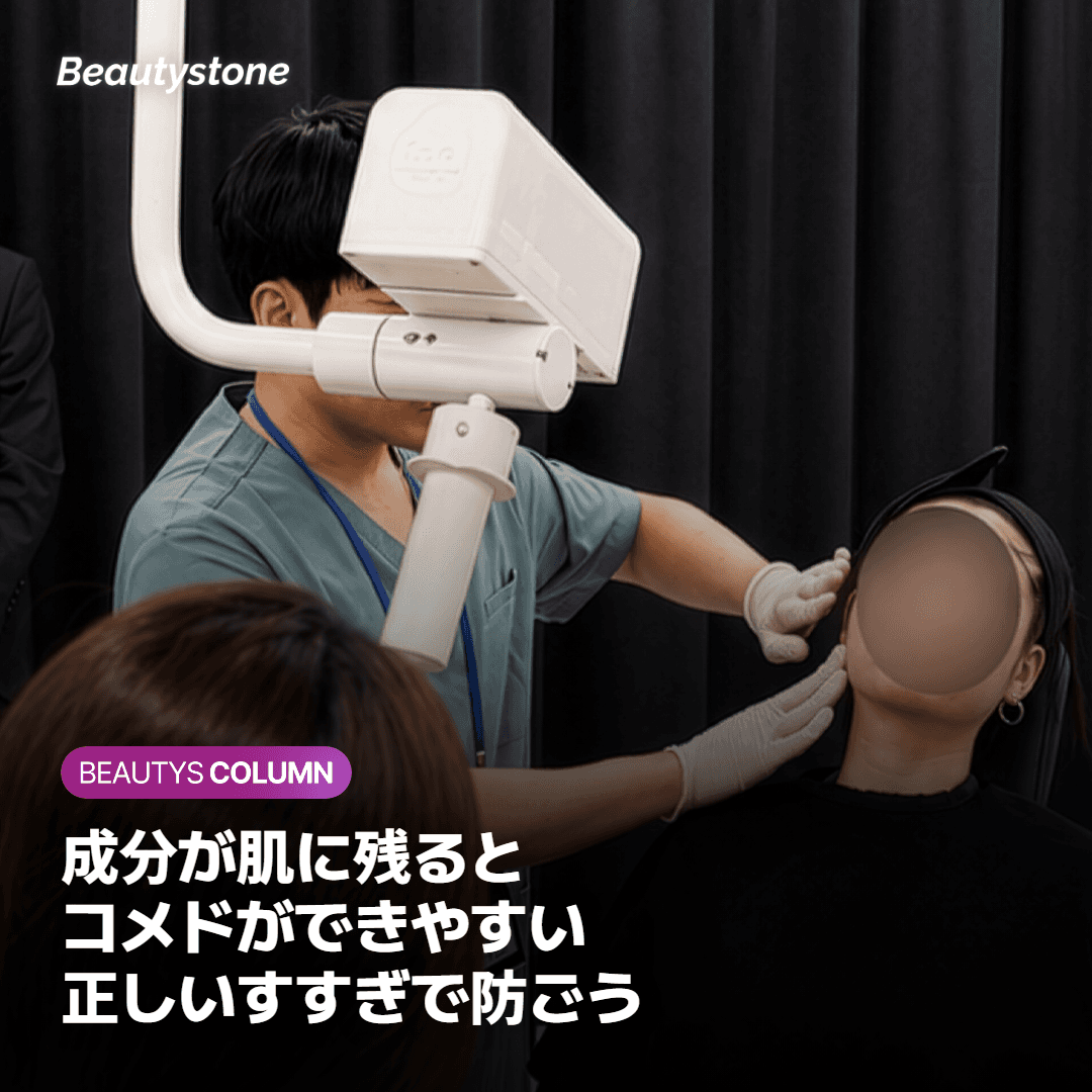 シャンプー成分がニキビを引き起こす仕組み