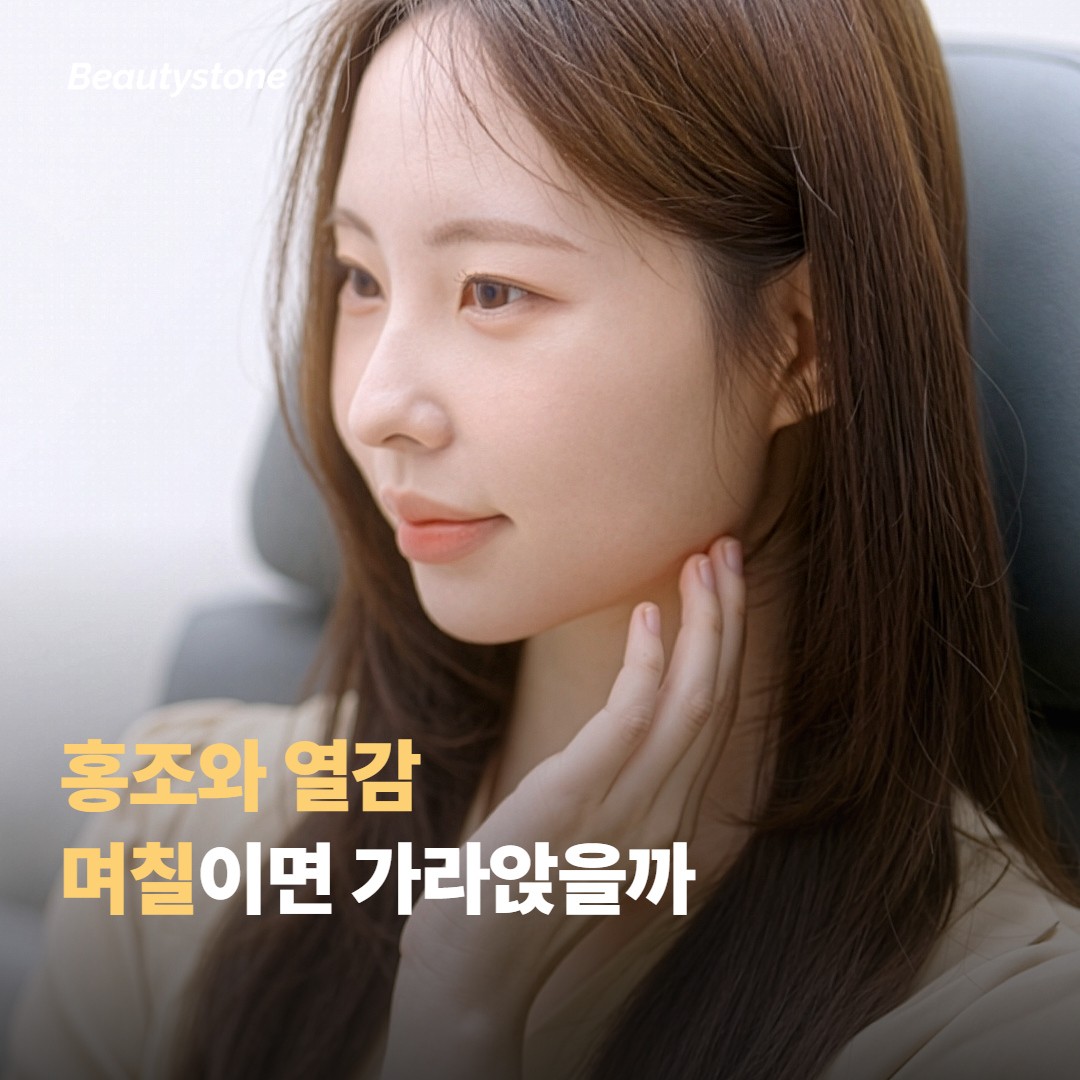 홍조와 열감은 며칠이면 가라앉나요