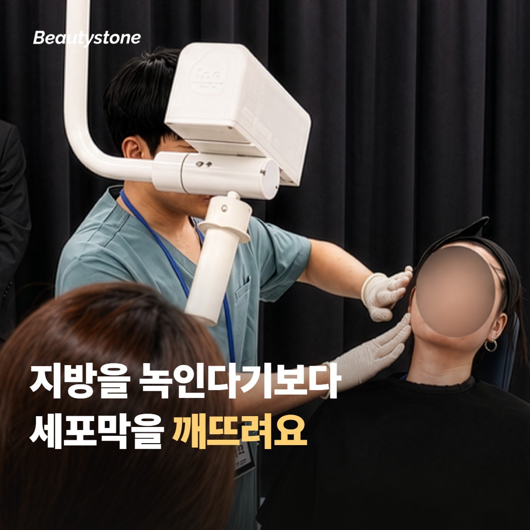 지방분해주사(DCA)가 어떤 시술인가요?