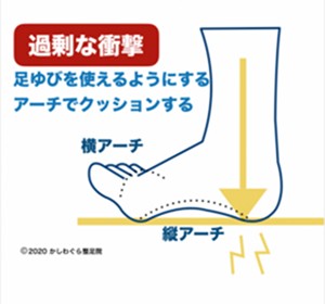 過剰な衝撃の図解イメージ