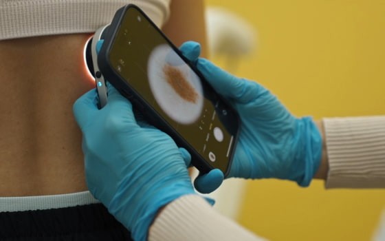 Лікар перевіряє шкіру пацієнта