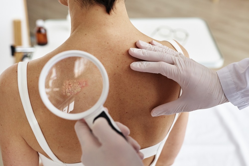 Psoriasis examination