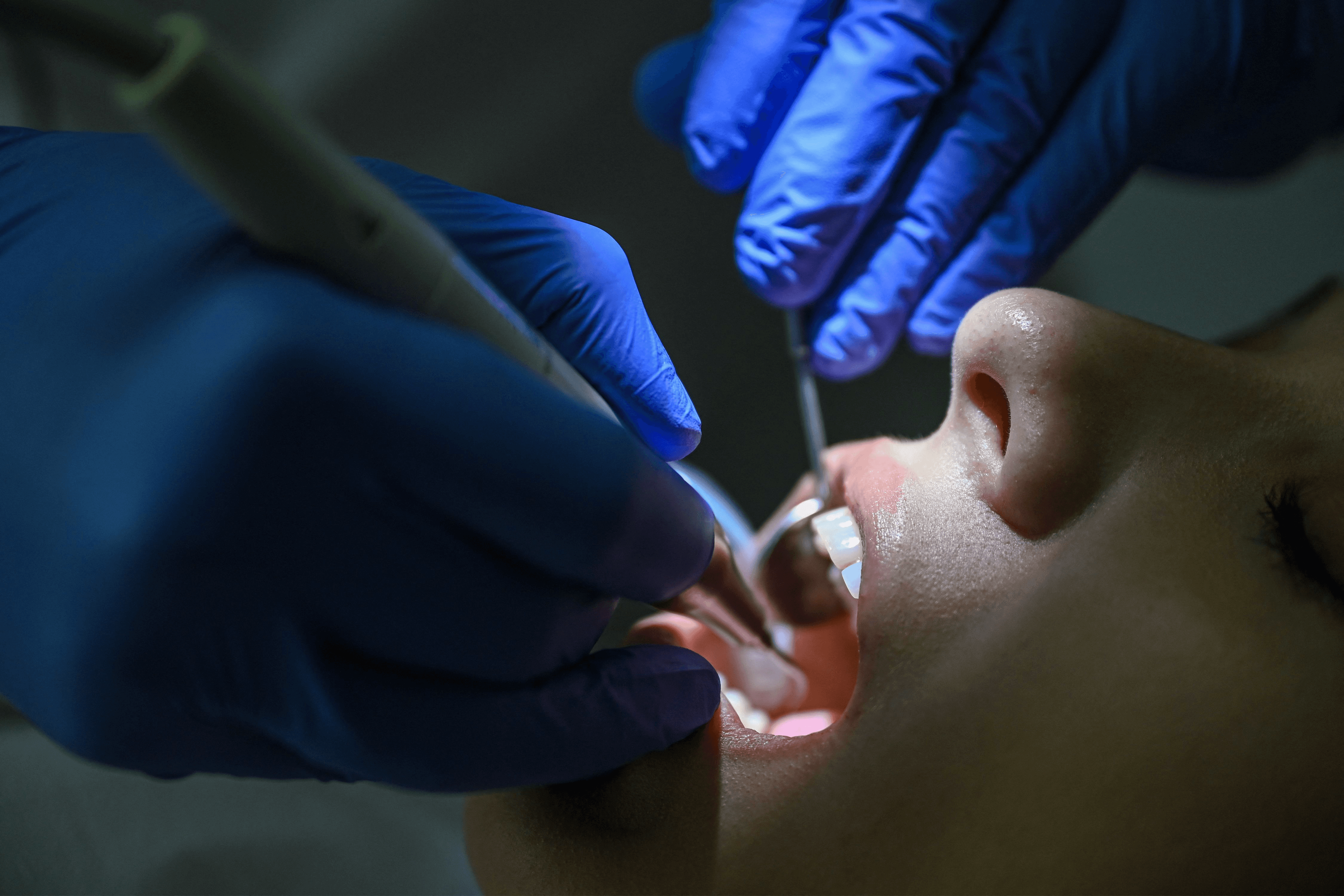 Man brushing his white teeth