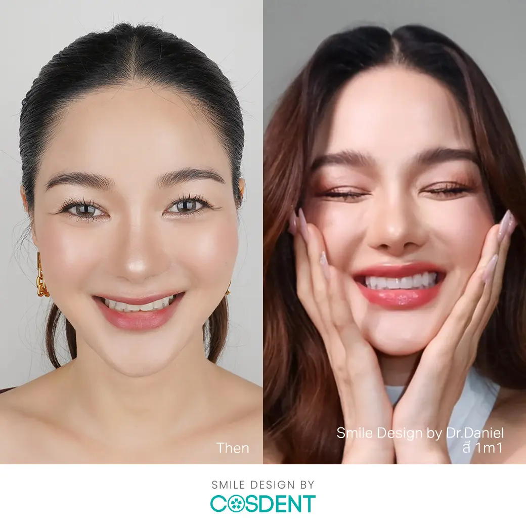 ผู้เชียวชาญแก้ไขทุกความกังวล รอยยิ้ม ที่ cosdent smile design