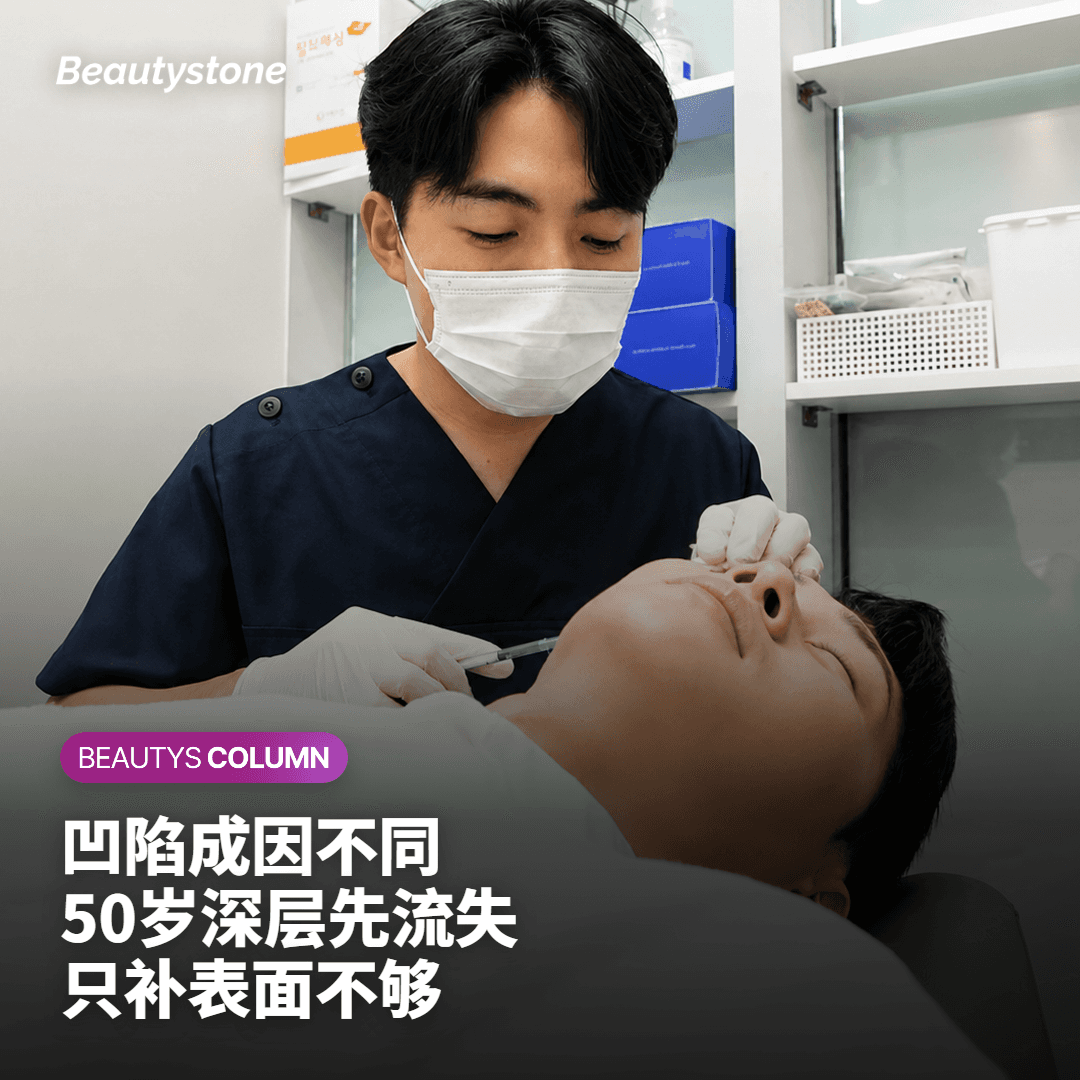 50多岁的面颊凹陷，成因和30多岁不同