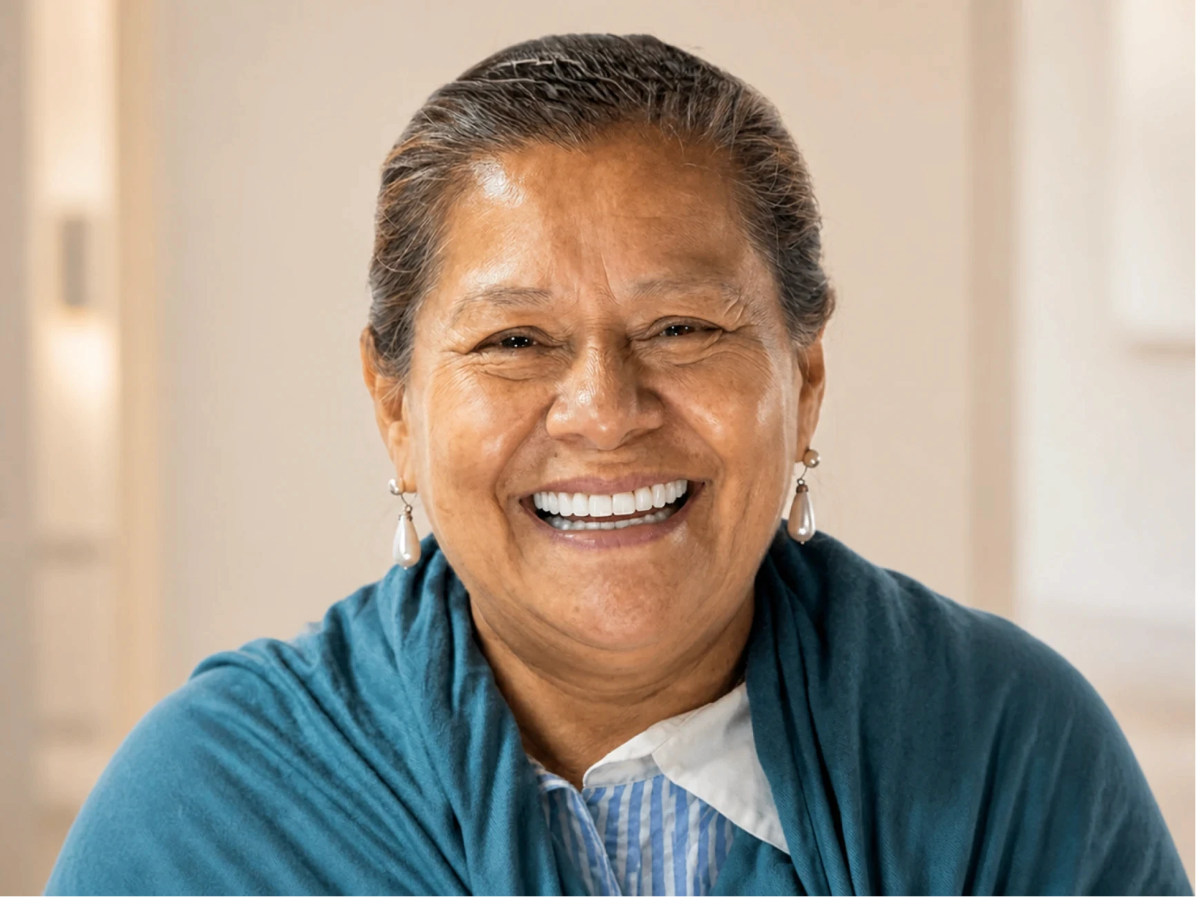 Patient 1 after full-arch dental implant treatment at lleveza